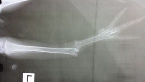 Broken leg of kiwi caught in trap